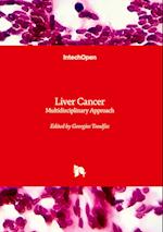 Liver Cancer - Multidisciplinary Approach