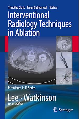 Interventional Radiology Techniques in Ablation