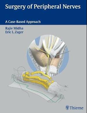 Surgery of Peripheral Nerves : A Case-Based Approach