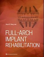 Full-Arch Implant Rehabilitation