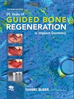 20 Years of Guided Bone Regeneration in Implant Dentistry