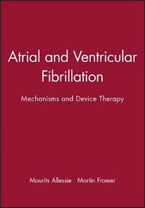 Atrial and Ventricular Fibrillation