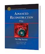 Advanced Reconstruction - Hip