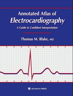 Annotated Atlas of Electrocardiography