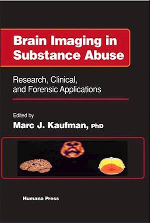 Brain Imaging in Substance Abuse