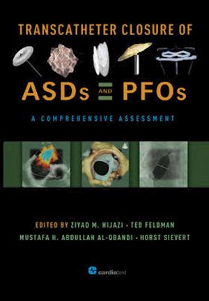 Transcatheter Closure of Asds and Pfos