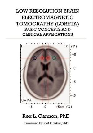 Low Resolution Brain Electromagnetic Tomography (LORETA)