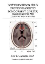 Low Resolution Brain Electromagnetic Tomography (LORETA)