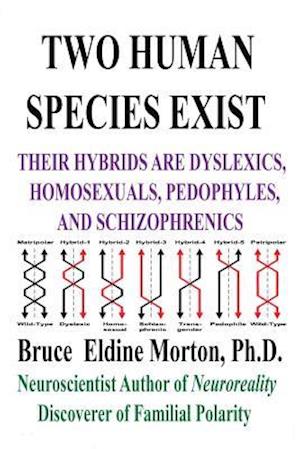 Two Human Species Exist: Their Hybrids Are Dylsexics, Homosexuals, Pedophiles, and Schizophrenics