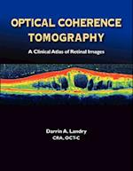 Optical Coherence Tomography a Clinical Atlas of Retinal Images