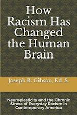 How Racism Has Changed the Human Brain