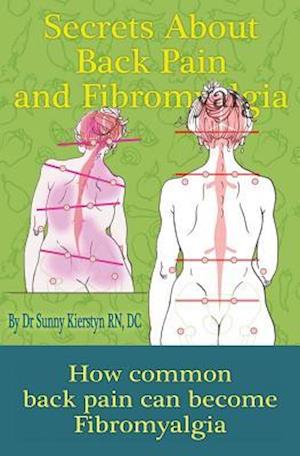 Secrets about Back Pain and Fibromyalgia