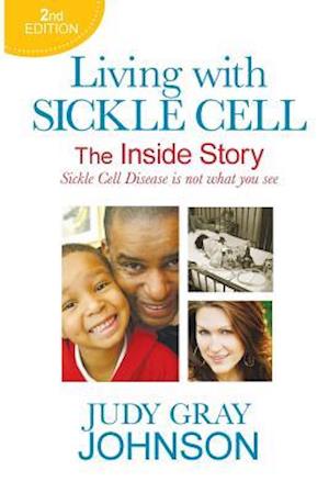 Living with Sickle Cell