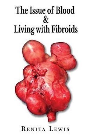 The Issue Of Blood & Living with Fibroids