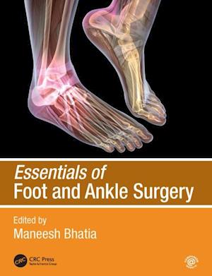 Essentials of Foot and Ankle Surgery