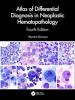 Atlas of Differential Diagnosis in Neoplastic Hematopathology