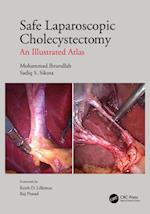 Safe Laparoscopic Cholecystectomy