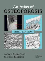 An Atlas of Osteoporosis