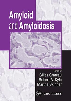 Amyloid and Amyloidosis