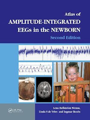 Atlas of Amplitude-Integrated EEGs in the Newborn