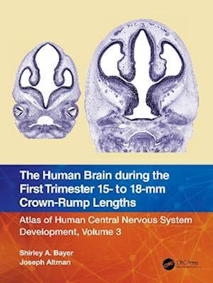 Human Brain during the First Trimester 15- to 18-mm Crown-Rump Lengths