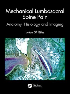 Mechanical Lumbosacral Spine Pain