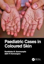 Paediatric Cases in Coloured Skin