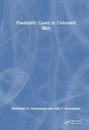 Paediatric Cases in Coloured Skin