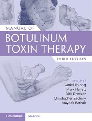 Manual of Botulinum Toxin Therapy