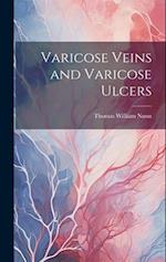 Varicose Veins and Varicose Ulcers 