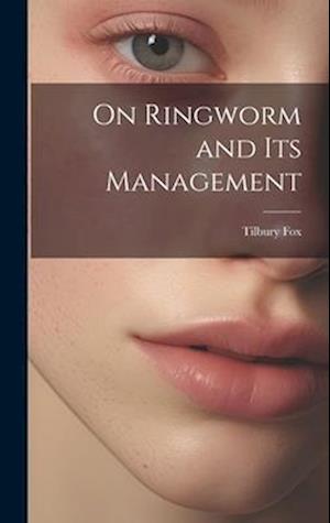 On Ringworm and Its Management