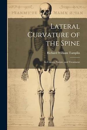 Lateral Curvature of the Spine: Its Causes, Nature, and Treatment