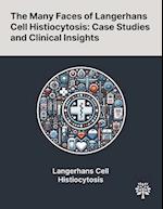 The Many Faces of Langerhans Cell Histiocytosis