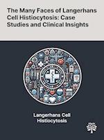 The Many Faces of Langerhans Cell Histiocytosis