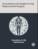 Innovations and Insights in Hip Replacement Surgery