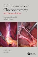 Safe Laparoscopic Cholecystectomy