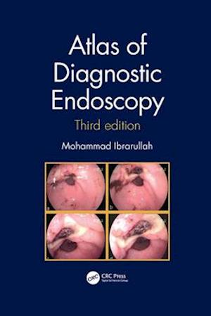 Atlas of Diagnostic Endoscopy, 3E