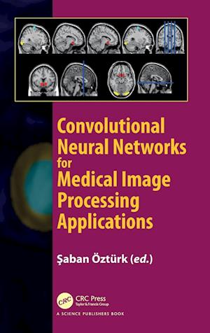 Convolutional Neural Networks for Medical Image Processing Applications