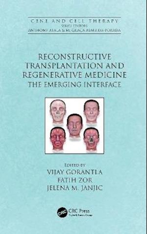 Reconstructive Transplantation and Regenerative Medicine