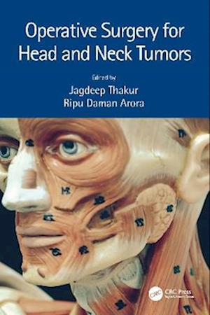 Operative Surgery for Head and Neck Tumors