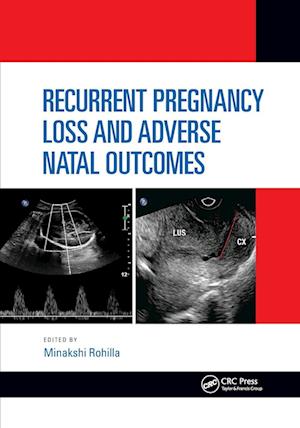 Recurrent Pregnancy Loss and Adverse Natal Outcomes