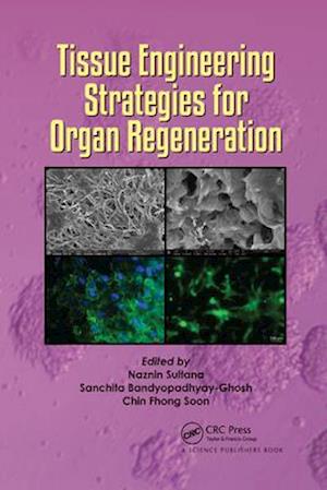 Tissue Engineering Strategies for Organ Regeneration