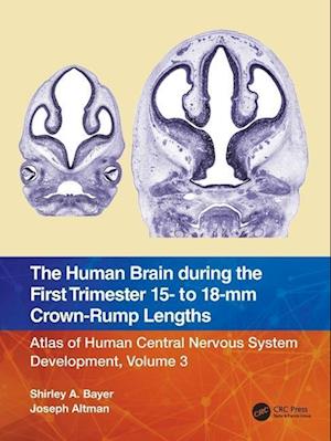 The Human Brain during the First Trimester 15- to 18-mm Crown-Rump Lengths