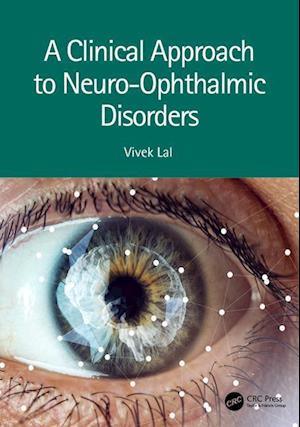 A Clinical Approach to Neuro-Ophthalmic Disorders