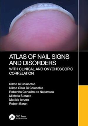 Atlas of Nail Signs and Disorders with Clinical and Onychoscopic Correlation