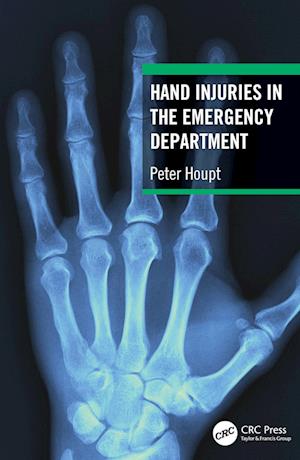 Hand Injuries in the Emergency Department