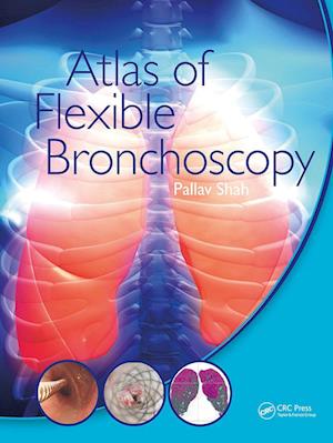 Atlas of Flexible Bronchoscopy