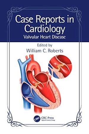 Case Reports in Cardiology