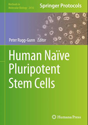 Human Naïve Pluripotent Stem Cells