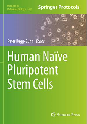 Human Naïve Pluripotent Stem Cells